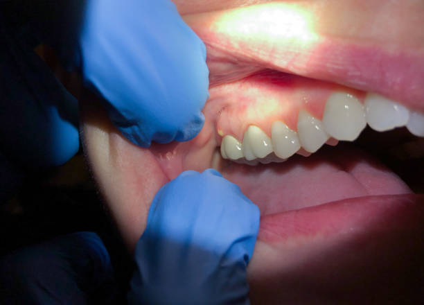 Best Emergency Treatment for Jaw Pain or Injury in Millen, GA