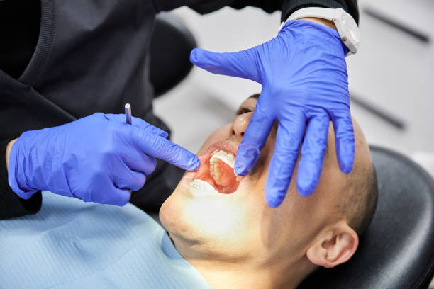 Best Dental Abscess Treatment in Millen, GA